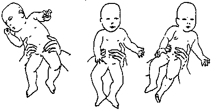 asym3